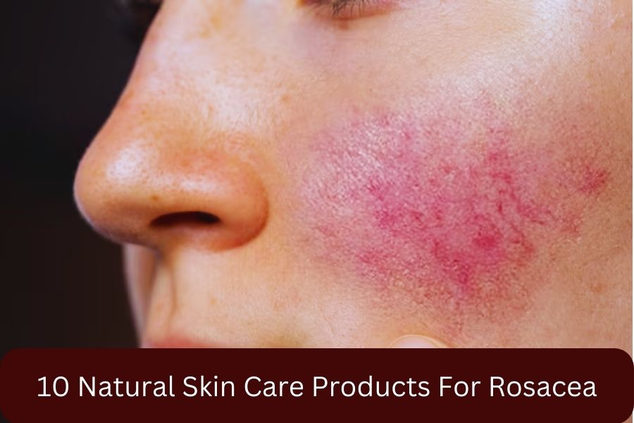 10 Natural Skin Care Products For Rosacea