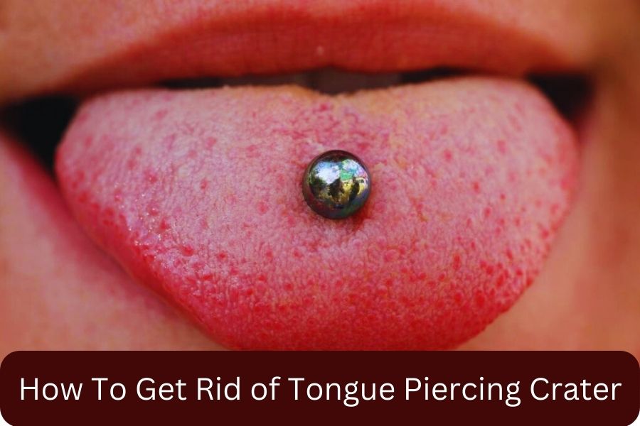 How To Get Rid of Tongue Piercing Crater - Health and Fitness ...