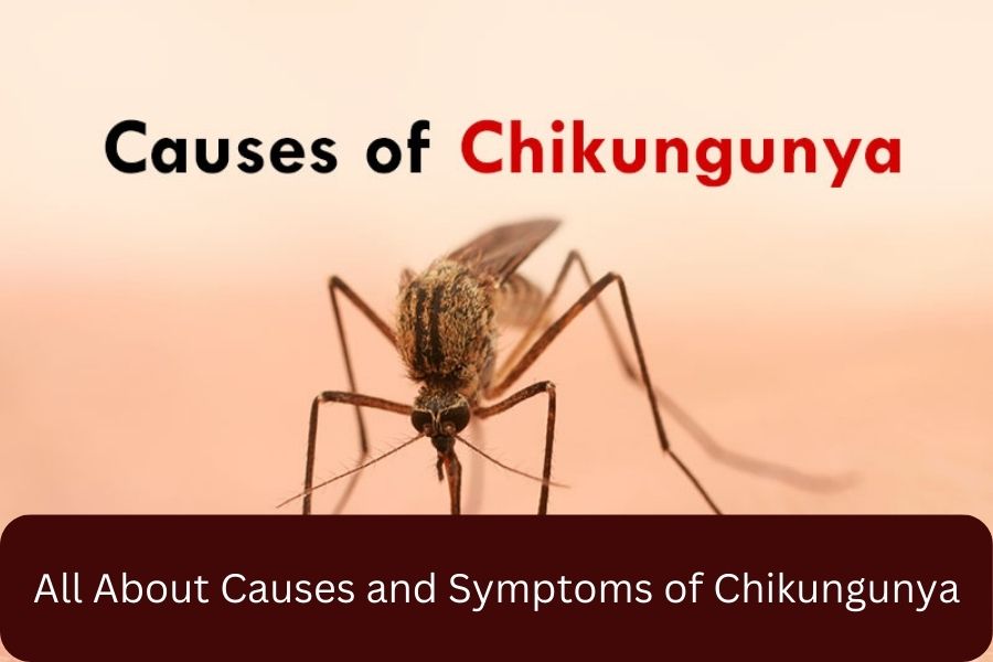 All About Causes and Symptoms of Chikungunya