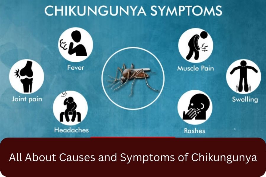 All About Causes and Symptoms of Chikungunya