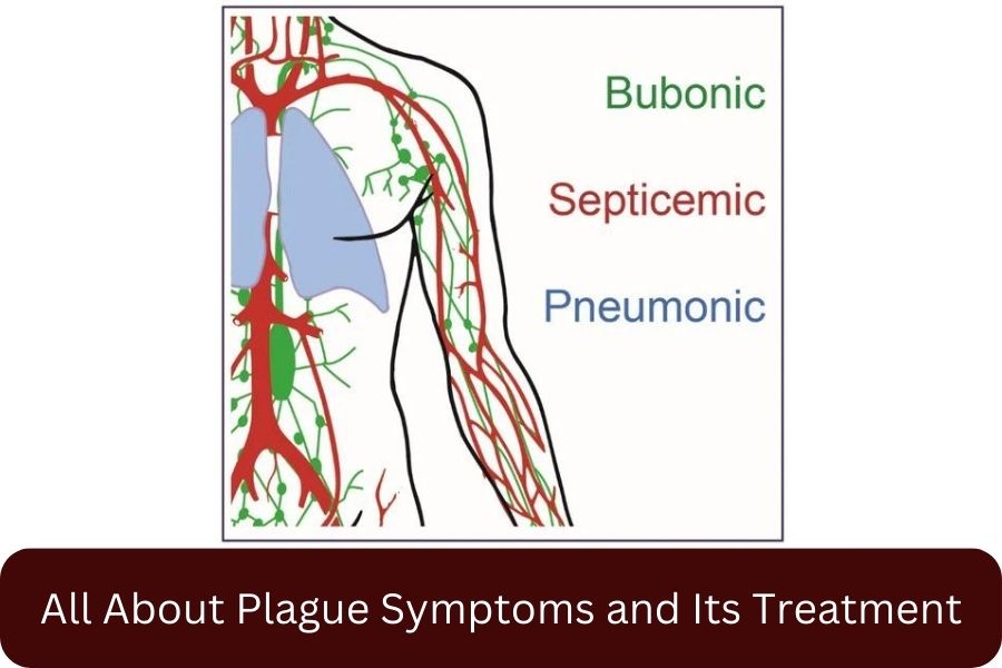 Septicemic plague