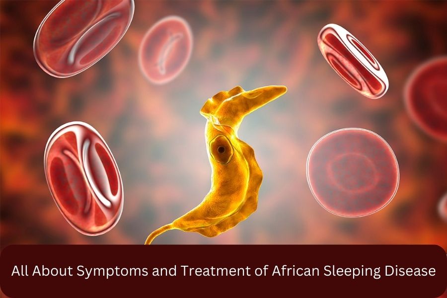 All About Symptoms and Treatment of African Sleeping Disease