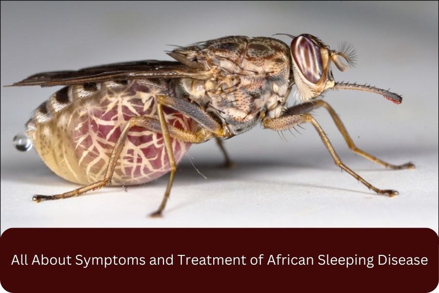 All About Symptoms and Treatment of African Sleeping Disease