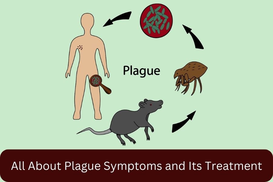 All About Plague Symptoms and Its Treatment