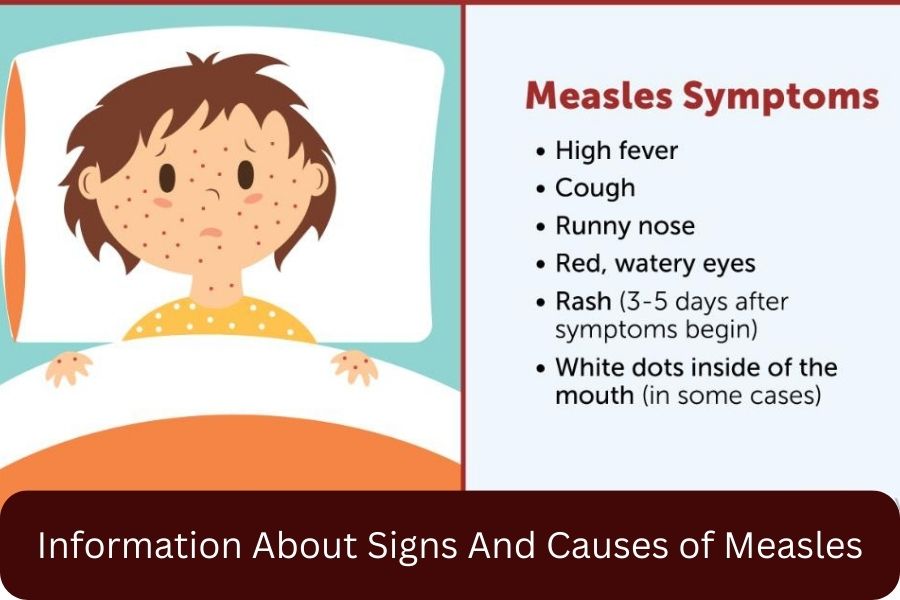 Information About Signs And Causes of Measles