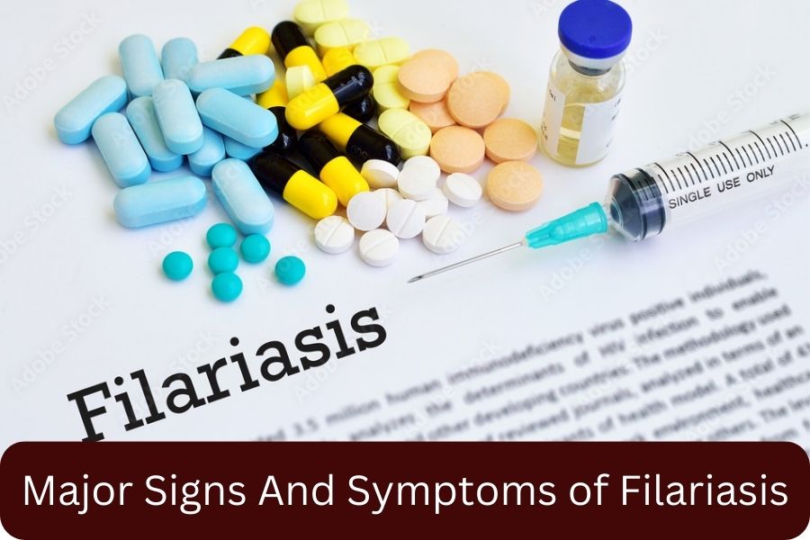 Major Signs And Symptoms of Filariasis